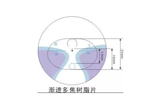 美麗島漸進多焦鏡適合的人群，需要注意的事項
