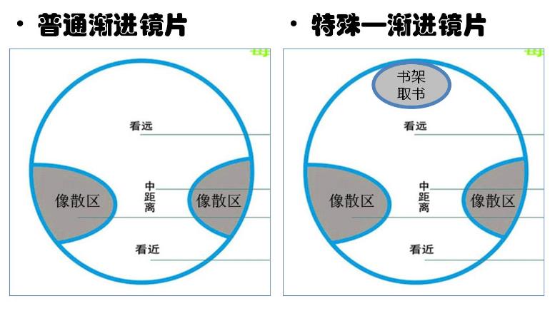 漸進(jìn)多焦鏡的原理與應(yīng)用，3個光區(qū)，看遠(yuǎn)近只需一副